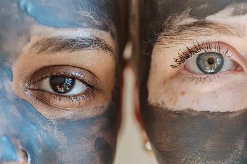 Hydrafacial before-after